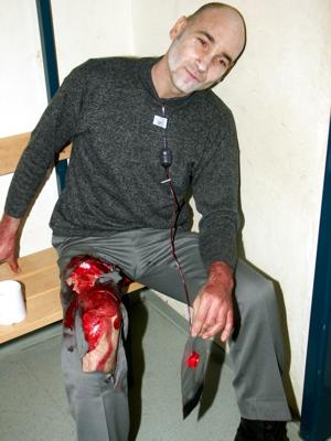 stark blutende Wunde mit Schock